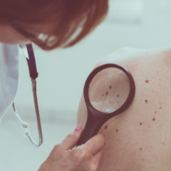 skin check